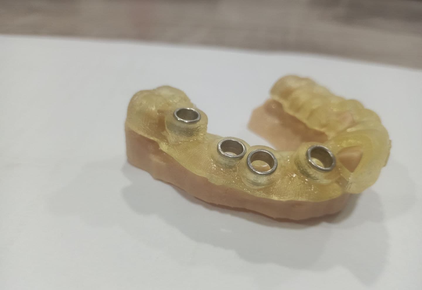 3D-printed surgical guide with metal sleeves seated on a printed model